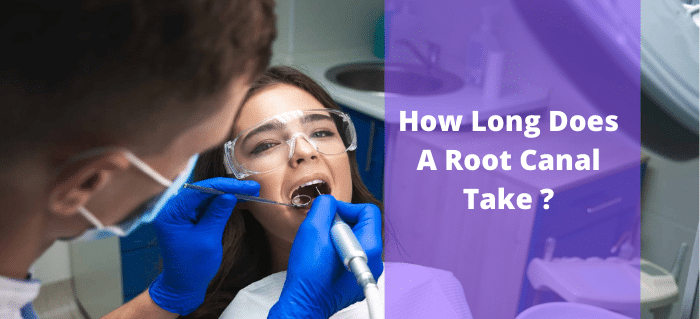 how Long Does A Root Canal Take